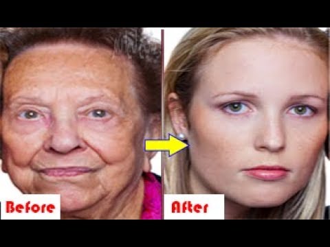 لايف ستايلبالفيديو: خلطة لإزالة التجاعيد العميقة أفضل من البوتكس والشد80799/0