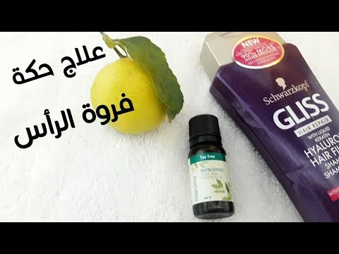 لايف ستايلشاهد: كيفية علاج الحكة الشديدة في فروة الرأس 81205/0