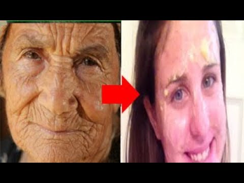 لايف ستايلبالفيديو: إزالة التجاعيد في 20 دقيقة82110/0