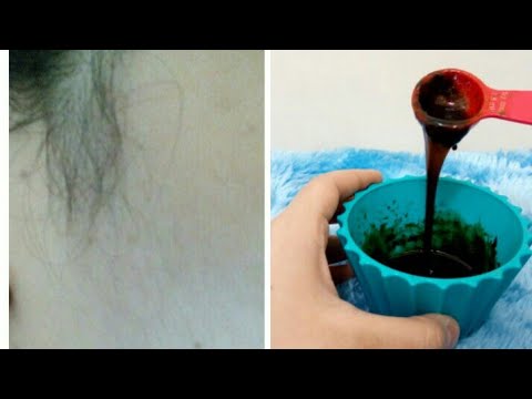 لايف ستايلشاهد: وصفة جديدة للتخلّص من شعر الوجه82607/0