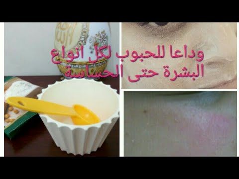 لايف ستايلطرق بسيطة للتغلب على حب الشباب82934/0