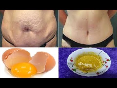 لايف ستايلوصفة بسيطة لكيفية إذابة الدهون82955/0