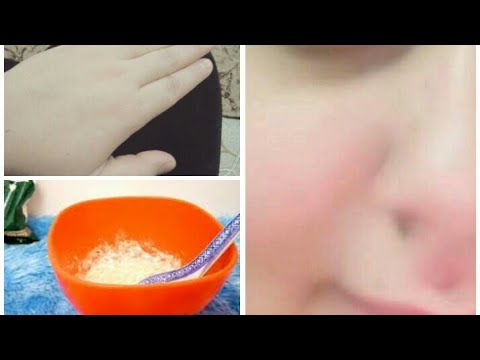 لايف ستايلشاهد: سر جمال بشرة اللبنانيات ماسك التبيض اليومي لبشرة كالقمر بنصف ساعة 83539/0