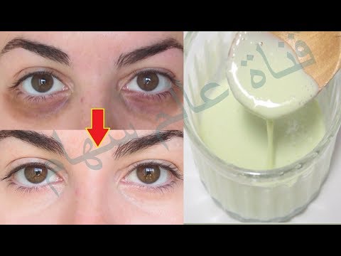 لايف ستايلوصفة لإزالة الهالات السوداء بسرعة83718/0