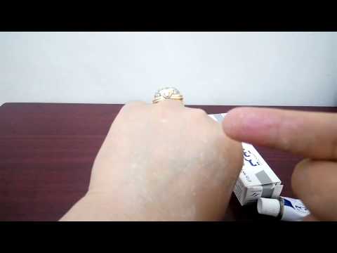 لايف ستايلشاهد: كريم تبيض البشرة وتفتيحها بشكل بسيط 84331/0