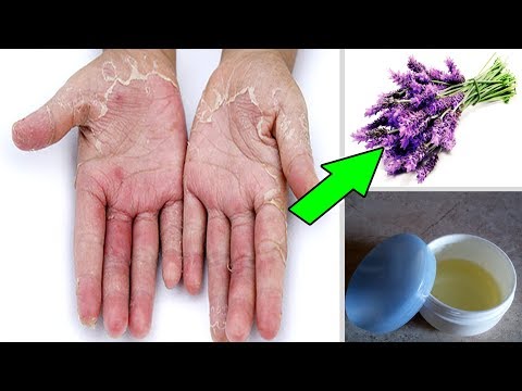 لايف ستايلبالفيديو: أحدث وصفة لعلاج الإكزيما والحكة الجلدية84719/0