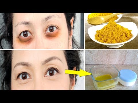 لايف ستايلبالفيديو: كيف تتخلصين من الهالات السوداء84723/0