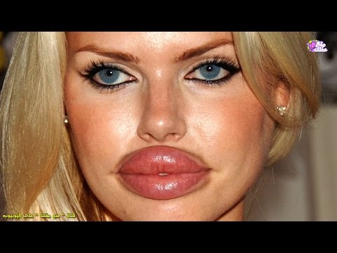 لايف ستايلشاهد| أسوأ 10 عمليات تجميل انتهت بنتائج كارثية لأصحابها85039/0