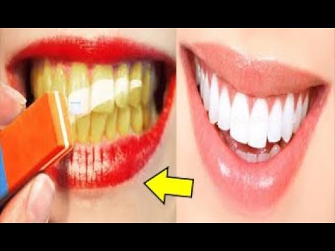 لايف ستايلبالفيديو وصفة منزلية لتبييض الأسنان في أقل من دقيقتين85570/0