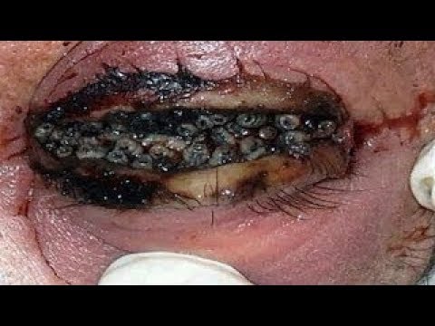 لايف ستايلسيدة تُخرج شيئًا غريبًا من عينها85960/0