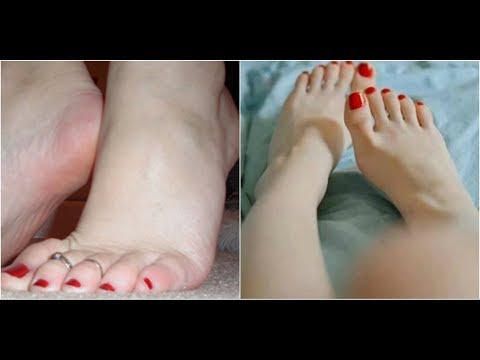 لايف ستايلفيديو وصفة لتبييض الأماكن السوداء في الجسم ليبدو جذابًا86001/0