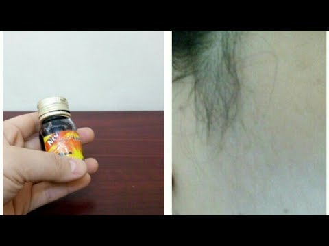 لايف ستايلشاهد| تخلصي من شعر العانة والوجة وكل الجسم بببديل رخيص لليزر86350/0