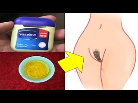 لايف ستايلبالفيديو: تخلصي من شعر العانة وشعر الجسم كله86370/0