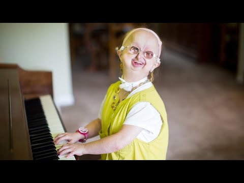 لايف ستايلشاهد: ميشيل كيش شابة عشرينية في جسد طفلة87809/0