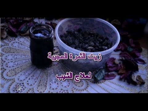 لايف ستايلشاهد: وصفة مميّزة للقضاء على الشعر الأبيض وتقصفه88138/0