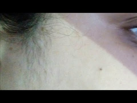 لايف ستايلشاهد: إزالة شعر الوجه الكثيف بطريقة مريحة 88881/0