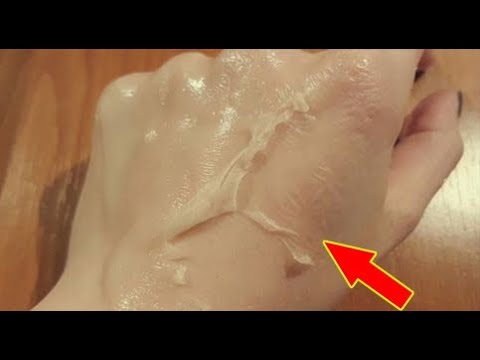 لايف ستايلشاهد: وصفة الليمون و الخميرة لإزالة الشعر الغير مرغوب فيه 88884/0