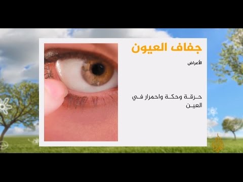 لايف ستايلشاهد: أسباب وعلاج مرض جفاف العيون15593/0
