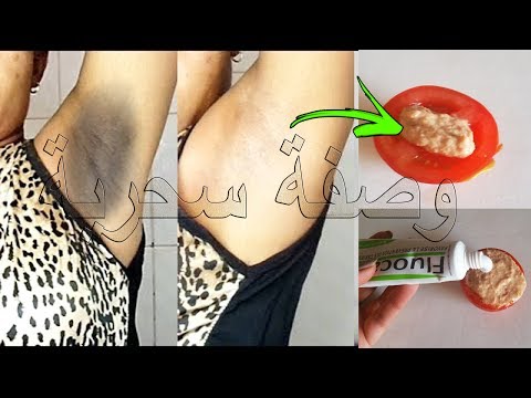 لايف ستايلبالفيديو :طريقة سهلة لتبييض تحت الإبط89479/0