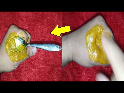 لايف ستايلشاهد: طريقة فعّالة للتخلص من البواسير89481/0