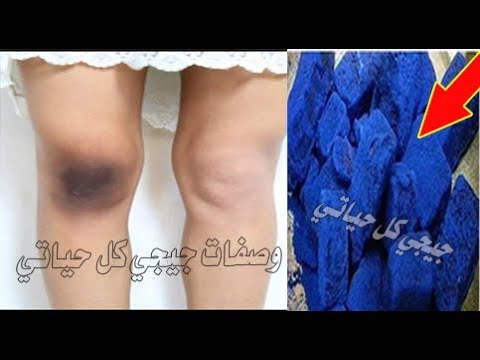 لايف ستايلشاهد: وصفة مضمونة لتبييض وتفتيح الركبتين والكوعين89551/0