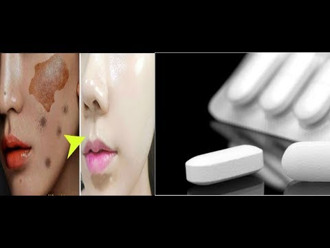 لايف ستايلشاهد: طريقة  سهلة لتبييض البقع السوداء المتراكمة89558/0