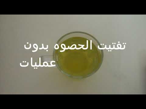 لايف ستايلشاهد: وصفة للتخلص من الحصوات وتحويلها إلى رماد89561/0