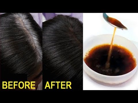 لايف ستايلشاهد: كيفية تحويل الشعر الأبيض إلى اللون الأسود طبيعيًا90073/0