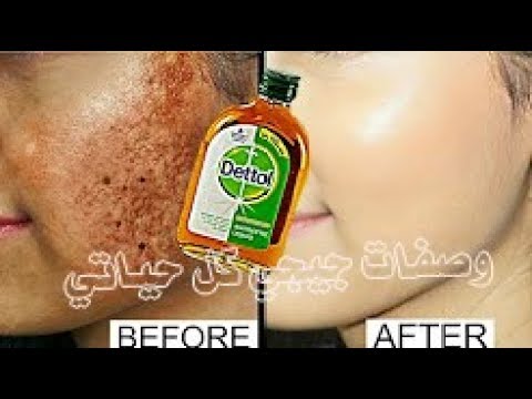 لايف ستايلشاهد: قطرتان مع اللبن وكوني بيضاء البشرة90222/0