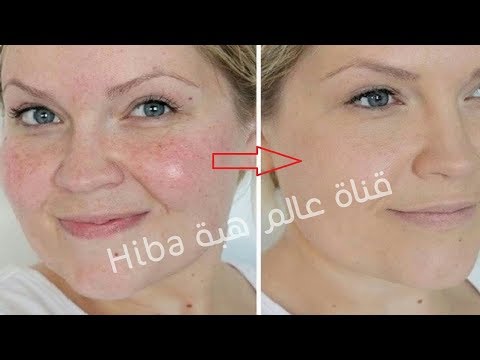 لايف ستايلبالفيديو: وصفة مذهلة لوجه مشرق ومشدود ولامع وصافي وأبيض كالقمر90918/0