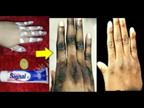 لايف ستايلشاهد: معجون الأسنان والليمون سيجعل يديك كاللبن91325/0