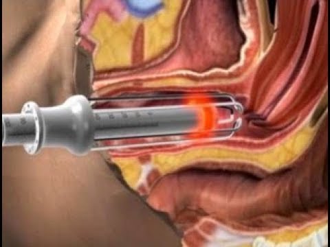 لايف ستايلتعرف على سبب استمرار نزول الدم بعد الإجهاض91524/0