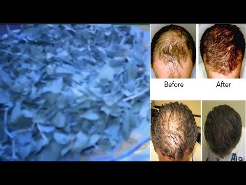 لايف ستايلشاهد: مكون معجزة من السُنة النبوية بوصفتين سحريتين لإنبات فراغات الشعر91747/0