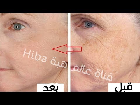 لايف ستايلشاهد:علاج قوي للتجاعيد وترهل البشرة91754/0