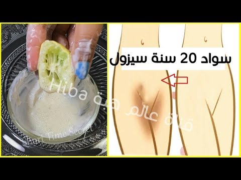 لايف ستايلشاهد: وصفة للتخلص من السواد بين الفخذين92245/0