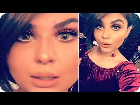 لايف ستايلشاهد: زينب غازي  تنفي خضوعها لعملية تجميل  في الفم92339/0