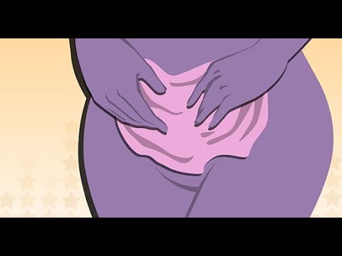 لايف ستايلوصفة طبيعية من الكركم والفازلين للقضاء على الإسمرار92412/0