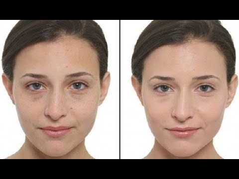 لايف ستايلشاهد: إليكِ الحل والوصفة السحرية للقضاء على البشرة الشاحبة92778/0