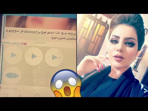 لايف ستايلالفنانة حليمة بولند تشعر بالصدمة93376/0