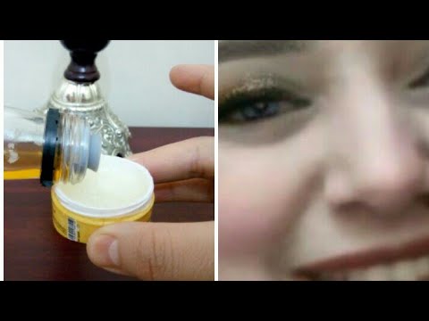 لايف ستايلشاهد: تأثير خل التفاح لتبييض الجسم93393/0