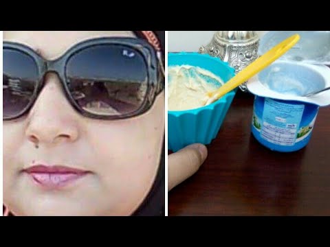 لايف ستايلشاهد: وصفات للوقاية من اسمرار البشرة93921/0