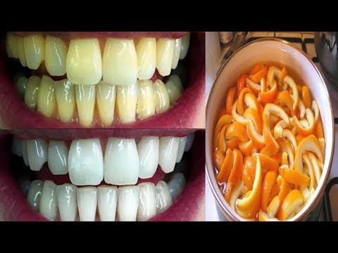 لايف ستايلخليط فعّال لتبيض الأسنان من أول استعمال93934/0