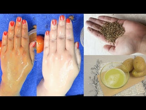 لايف ستايلشاهد: خلطة من الجزر والبطاطا لتبييض اليدين93938/0