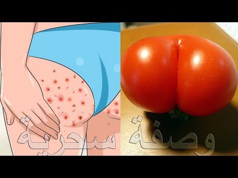 لايف ستايلوصفة لتبيض المؤخرة بشكل رائع94104/0