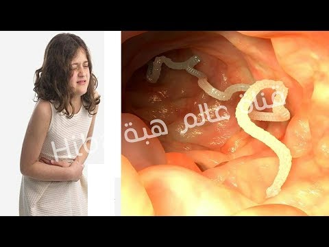 لايف ستايلشاهد: طريقة التخلص من الديدان عند الأطفال94322/0
