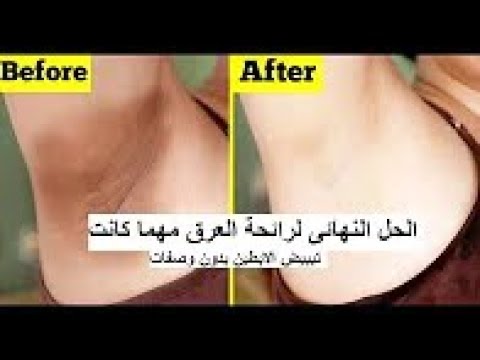 لايف ستايلشاهد: مكون يبيض تحت الإبطين94330/0