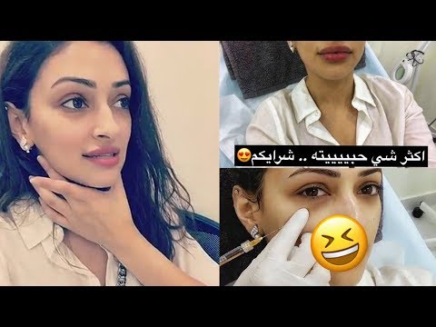 لايف ستايلشاهد: رد فعل شوق الهادي إثر نفخ شفاهها94341/0