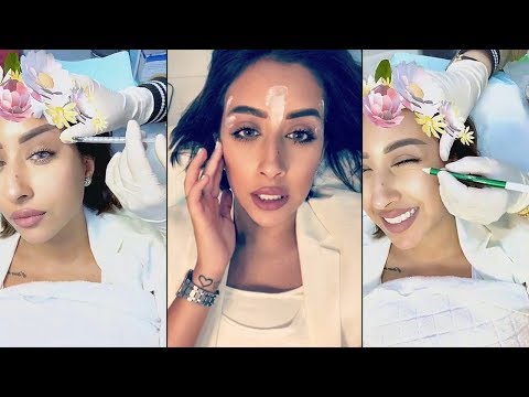 لايف ستايلفرح الهادي تجري جرحة ليزر وبوتكس للوجه94793/0