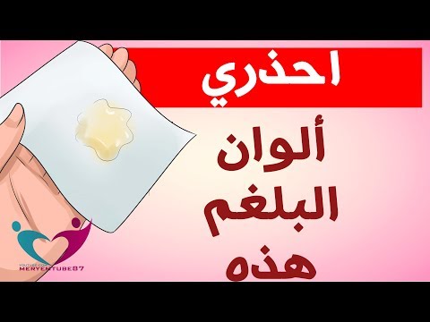 لايف ستايلشاهد: يُمكنك التعرّف على نوع المرض مِن لون البلغم95132/0
