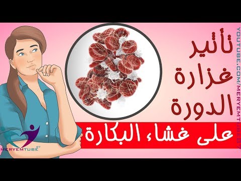 لايف ستايلبالفيديو: تأثير غزارة الدورة على غشاء البكارة95250/0